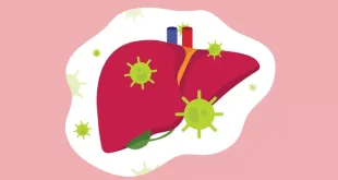 penyakit Hepatitis A